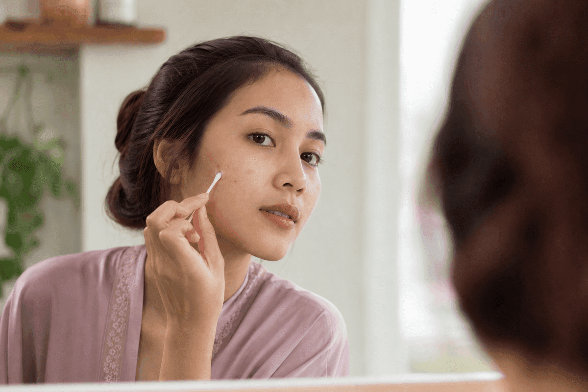 Cara menghilangkan jerawat dengan obat totol — perempuan mengoleskan krim ke jerawat di pipinya memakai cotton bud