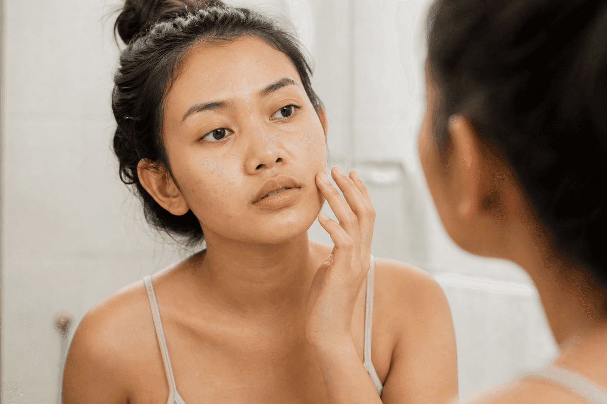 Perempuan muda mengamati jerawat di wajahnya di depan cermin dengan cahaya pagi yang lembut